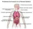 /album/fotogaleria/problemasfibrosis-gif/